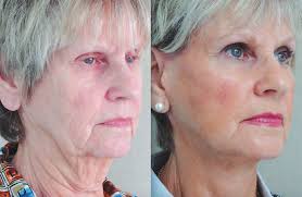 Officials seek to boost federal CARES aid