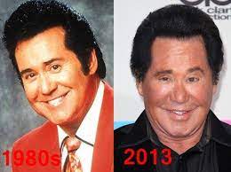 Wayne newton was confirmed for getting plastic surgery for his aging face during an episode of the bachelorette. Wayne Newton Before And After Plastic Surgery Http Www Plasticsurgeryindex Com Wayne Celebrity Plastic Surgery Wayne Newton Plastic Surgery Plastic Surgery