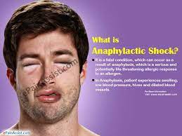 Anaphylaxis, a severe allergic reaction, is an emergency. What Is Anaphylactic Shock Causes Symptoms Treatment Prognosis Prevention