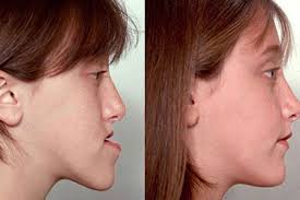 Jaw Problems Treatment Melbourne