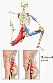 Tight hip flexors can be an annoying sensation for many lifters. Pin On Posture