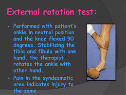 Image result for Ankle External Rotation Test