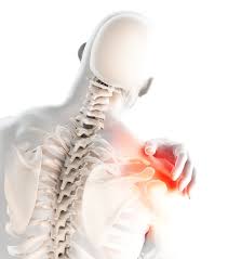 The deltoid muscles at the top of your shoulders are one of the prime movers in the shoulder press. 6 Home Remedies For Shoulder Pain