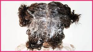 There was an article published in the british journal of dermatology in august 2001 that detailed the results of a small study done on african hair growth parameters. How To Make Black Hair Grow Faster Longer Youtube