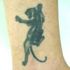 Our team of practitioners are highly qualified and skilled experts in skin rejuvenation and skincare. Tattoo Removal Reading Berkshire Chiltern Medical Clinics