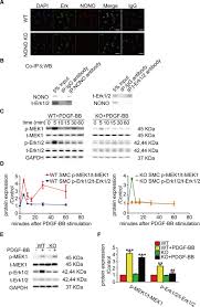 A way out pc game 2018 overview. Knockout Of The Nono Gene Inhibits Neointima Formation In A Mouse Model Of Vascular Injury Arteriosclerosis Thrombosis And Vascular Biology