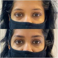 The average microblading technician can treat 2 clients per day. Becoming A Microblader Microblading
