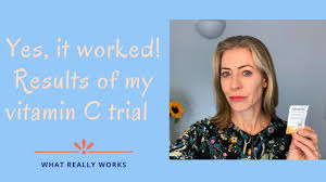 When is the best time of day to take your vitamin supplement? Can This Supplement Do As Much For Your Face As Skincare Youtube
