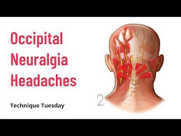 Pin On Migraines