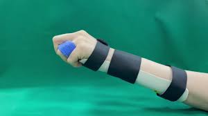 Image result for Hand Extensor Tendon Injury