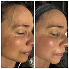 Savvy Skincare, 6111 Peachtree Dunwoody Rd, Atlanta, GA 30328, US