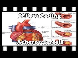 Icd 10 Coding Tutorial How To Code Atherosclerosis Youtube