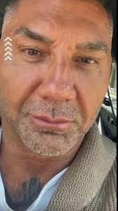 🤔📸 Did you see recent pics of #Batista?🦇 Fans are concerned about his  weight loss. Share your fave #WWE memories! . . . #MrBeast #ProWrestling  #HealthConcerns