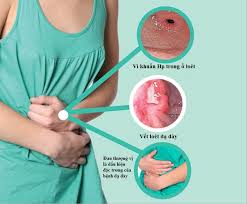 Maybe you would like to learn more about one of these? Muá»'n Chá»¯a Viem Loet Dáº¡ Day Tá»« Gá»'c Pháº£i Chá»n Ä'ung Cach