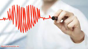 Maybe you would like to learn more about one of these? Immunohistochemical Diagnosis Of Epithelioid Mesothelioma Youtube