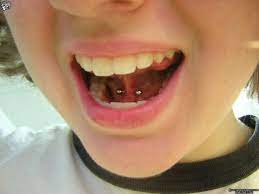 Illustrated Guide To Tongue Piercings Cute Piercings Tongue Piercing Piercings Unique