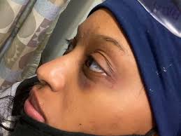 Paterson police brutality: Details vary in telling of 3 alleged cases