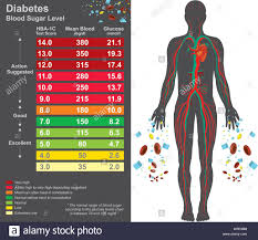Diabetes Chart Symptoms Of High Blood Sugar Include