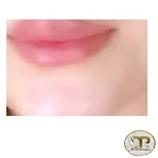 فيلر شفايف جلدية تجميل جلدية تجميل ليزر بوتكس فيلر فيلر شفايف بوتكس الوجه بوتكس تجاعيد الرياض الدوادمي تكساس فيلر ذقن صور هيدرافيشال