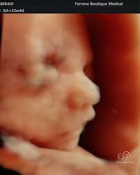 Morfologiile fetale sunt printre cele mai importante investigații din  timpul sarcinii și momentele în care viitorii părinți află informații  detaliate esențiale despre sănătatea și dezvoltarea bebelușului. Aici,  experiența și atenția medicului fac