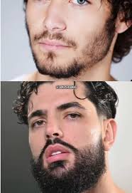 Rellenar Zonas Poco Pobladas de la Barba