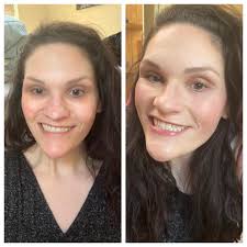 Hey Guys! In this video, I will be providing personal attention by way of a  quick five minute facial exam. I hope you enjoy and find it relaxing! 💙