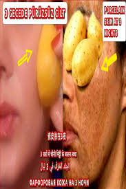 3 Gecede Puruzsuz Cilt Patates Limon Maskesi Dogal Patates Limon