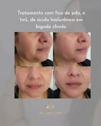 Danielle Fraga (@dra.danifraga) • Instagram photos and videos