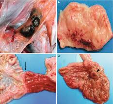 No antiviral medications have proved effective in treating infection with either ebola virus or marburg virus. Ebola Hemorrhagic Fever Radiology Key