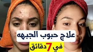 علاج حبوب الجبهه والوجه علاج حب الشباب في الجبهة للجنسين علاج الحبوب company logo tech company logos amazon logo