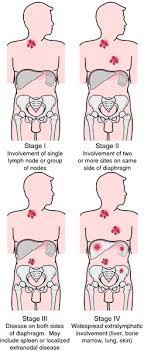 Pin On Nursing