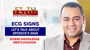 ECG signs 2, Let's talk about Spodick's Sign.