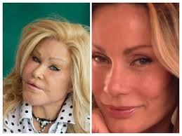 Are people better looking before plastic surgery?