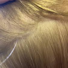 Hundreds of lice have been found on mummies dating back thousands of years. Lice Relief Dothan Home Facebook