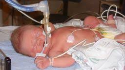 Cop donates kidney to child she'd never met