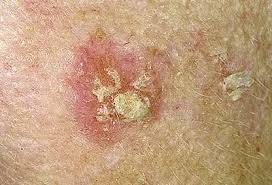 Image result for Oncinotis