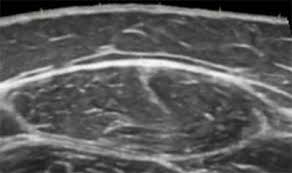 Manual of diagnostic ultrasound / edited by p. College News Ucf College Of Health Professions And Sciences