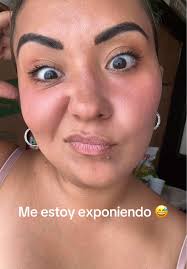 Impacto de los tratamientos dentales en embarazadas