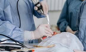 Image result for Sinus Surgery