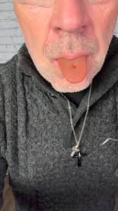 It just kept growing #healthtips #healthcare #Joker