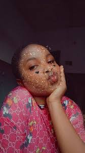 This is why you don't super glue your nails back