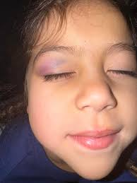 My baby won 3rd at his first tournament.