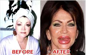 Sections show more follow today plastic surgery might not only help make people. 22 Most Shocking Celebrity Before And After Plastic Surgery Shots Celebrity Plastic Surgery Bad Plastic Surgeries Bad Celebrity Plastic Surgery
