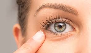 Bagaimana cara menghilangkan kantung mata dengan cepat secara alami? 2021 Top 5 Produk Hilangkan Eyebag Di Watson Beli Online Pun Boleh