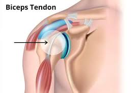 Shoulder radiology & anatomy at usuhs.mil. Does Your Shoulder Click Pop Catch Or Snap