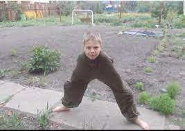 A doll's head left behind at chernobyl. Victim Of Chernobyl Meltdown Forced To Amputate Both Arms As Radiation Side Effects Worsen 1993 Fakehistoryporn