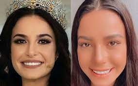 View latest posts and stories by @juliagamaofficial julia gama news fc in instagram. Julia Gama A Miss Brasil 2020 Mostra Resultado De Procedimento No Nariz Leve Mudanca Na Pontinha Flipboard