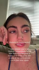Diabetic with Blue Vision Did They Busy Come Back