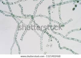 1) spirogyra under a commercial van leeuwenhoek replica microscope. Shutterstock Puzzlepix