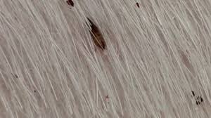 Where Do Fleas Lay Eggs Fleascience Fleas prefer living on animals like cats and dogs, though they will not hesitate on biting humans if they are unable to find a suitable animal. where do fleas lay eggs fleascience